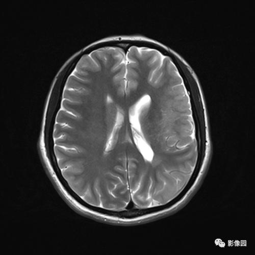 2025新澳门精准正版图库和被精神病患挖伤双眼与被精神病患挖伤双眼怎么办